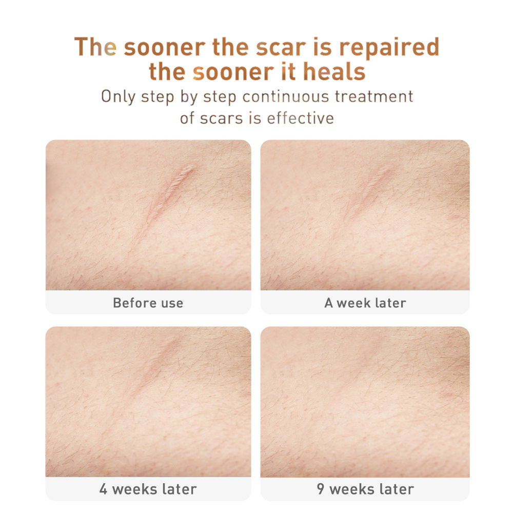 LANBENA -TCM Scar and Acne Mark Removal Gel Ointment 30g