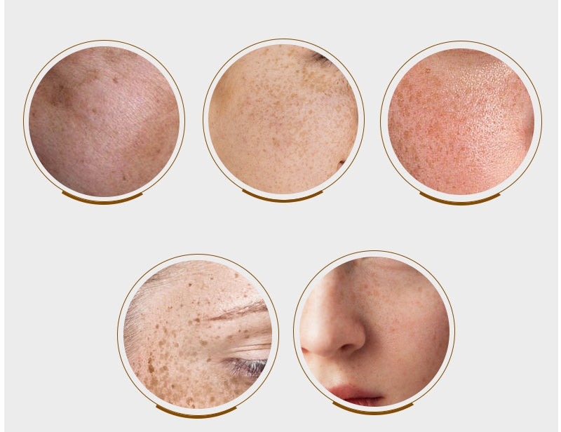Whitening Cream Spot Spot Pen Spot Spot Lotion LustrousShop