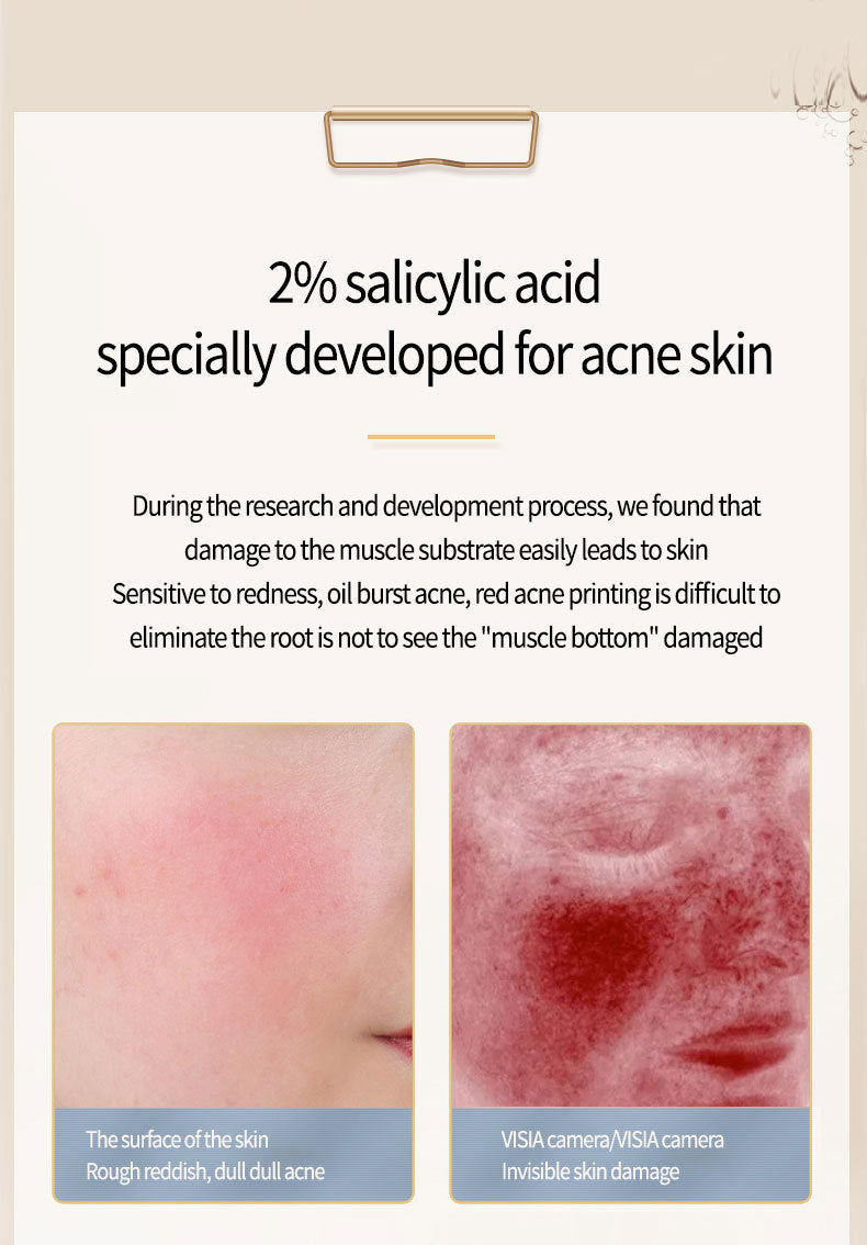 LanSIYI -Salicylic Acid Acne Serum 15ml