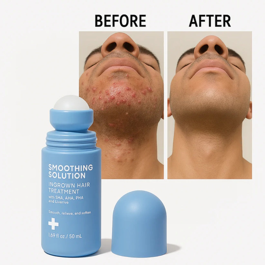 best ingrown hair serum