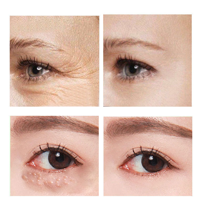 AnYi Beauty -Eye Cream 30ml