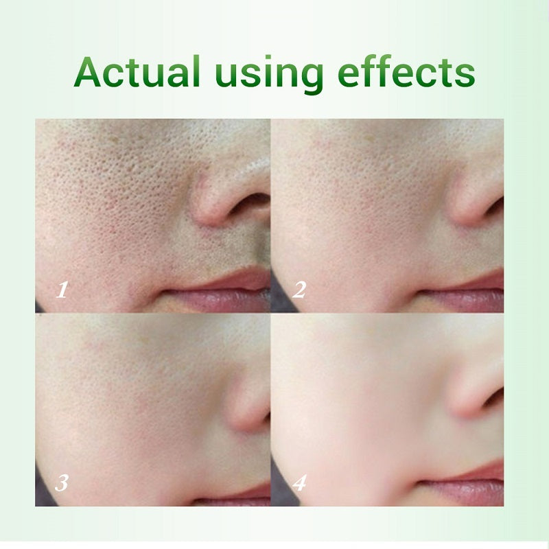 Salicylic Acid Pore Refinement Cream Lotion Skin Rejuvenation Cream Skin Care Products LustrousShop