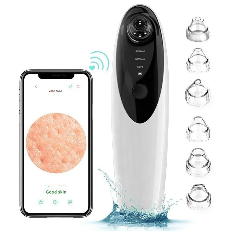 wireless blackhead remover