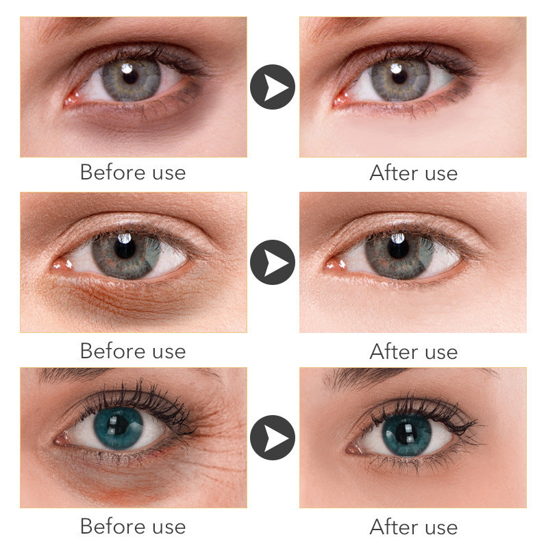 AnYi Beauty -Eye Cream 30ml