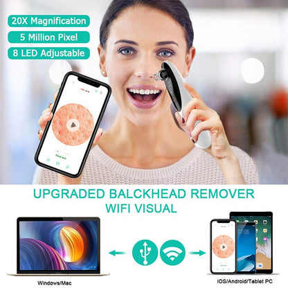face suction device